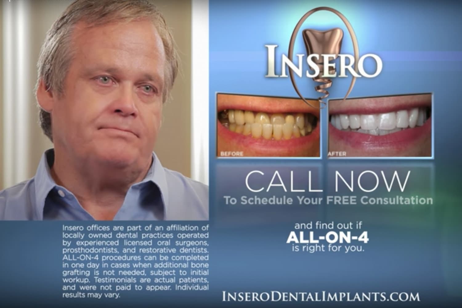 Insero Dental Implants