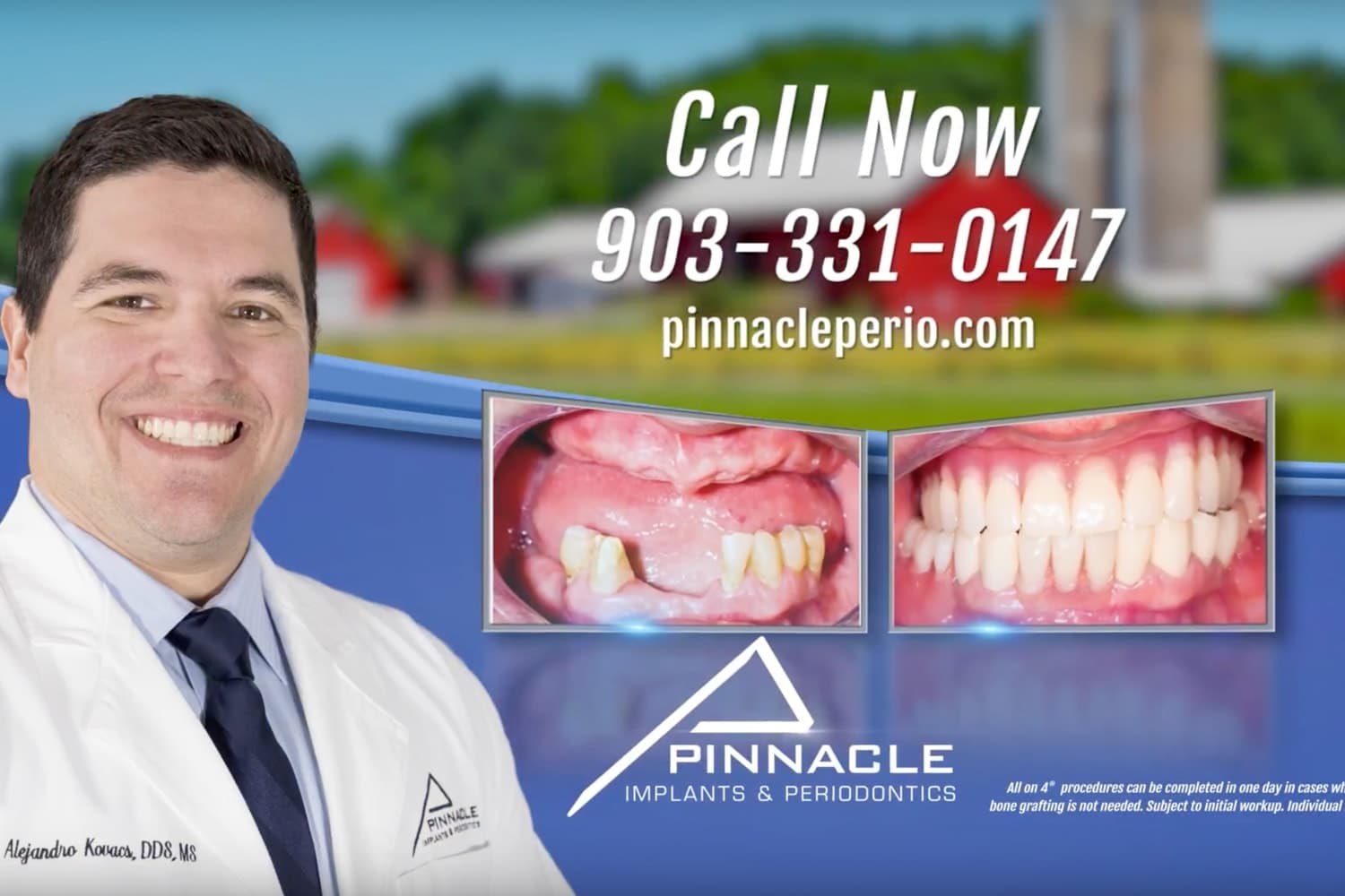 Pinnacle Implants & Periodontics Dental Marketing