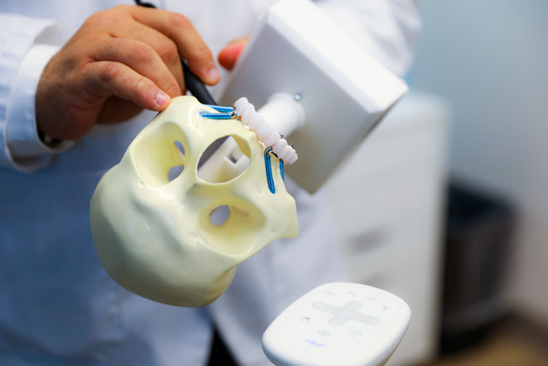 a model of a full arch implant being milled.