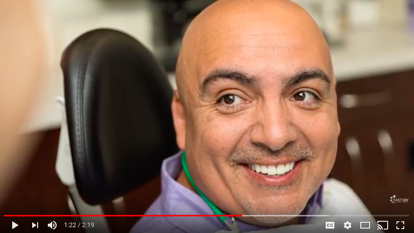Dental implant marketing|